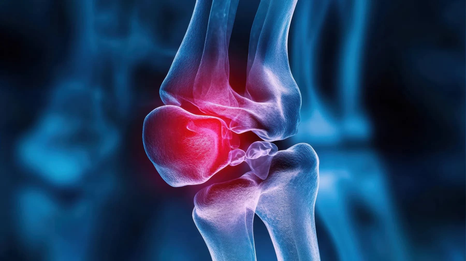 Illustration of joint inflammation - the science behind Bioiberica ingredients